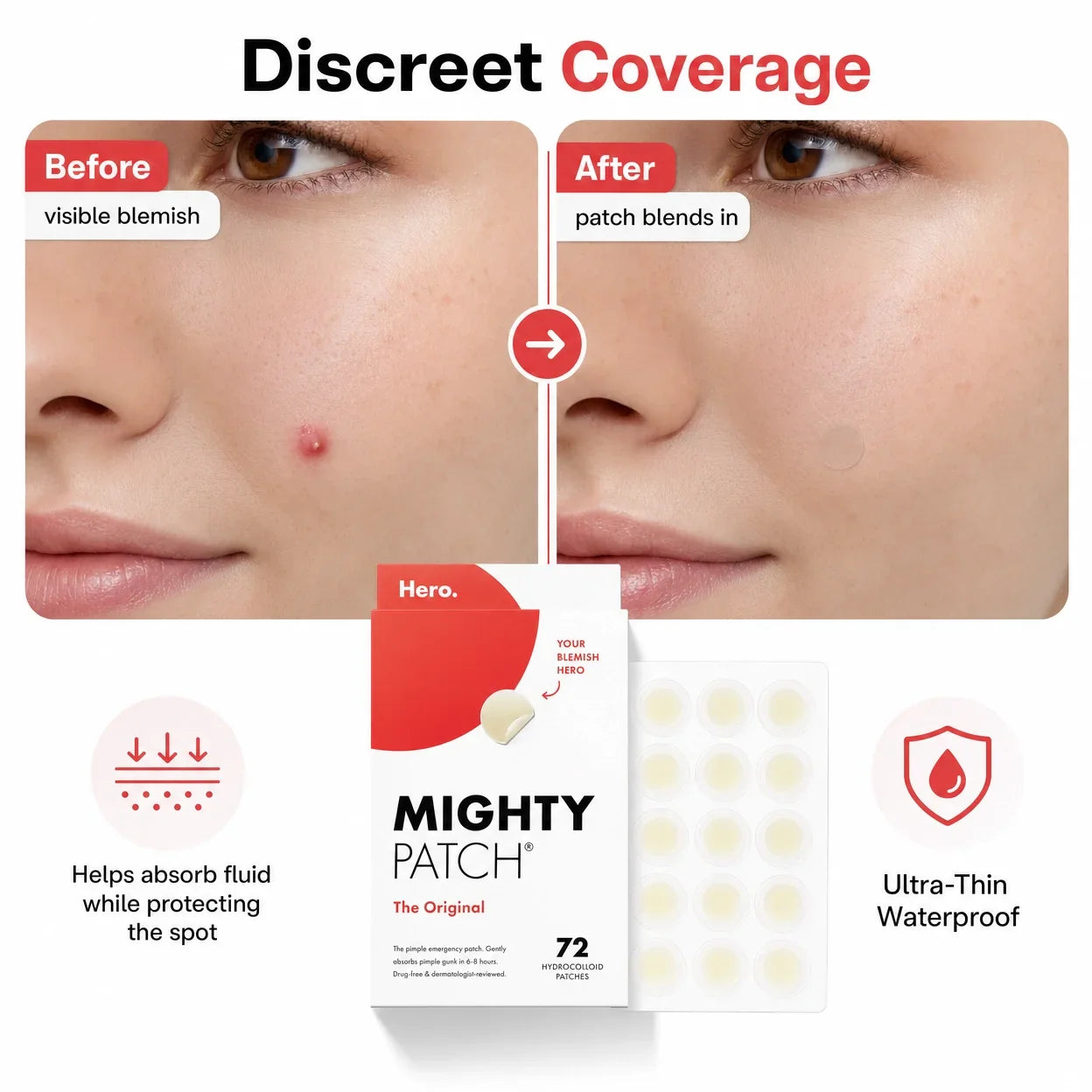 Gentle Acne Spot Patches
